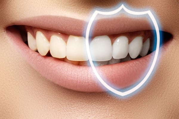 zoom teeth whitening